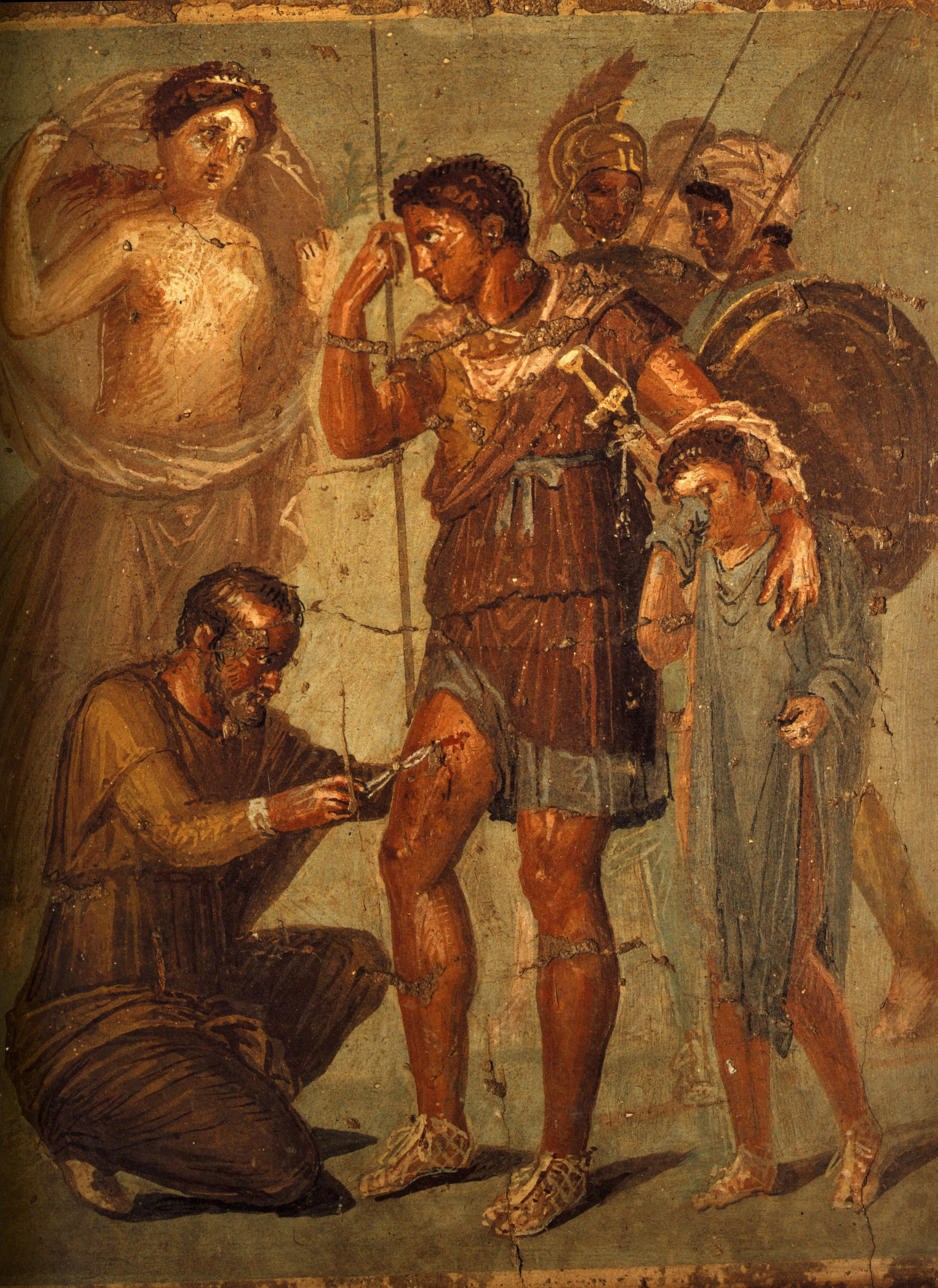 Aeneas treated by Iapyx